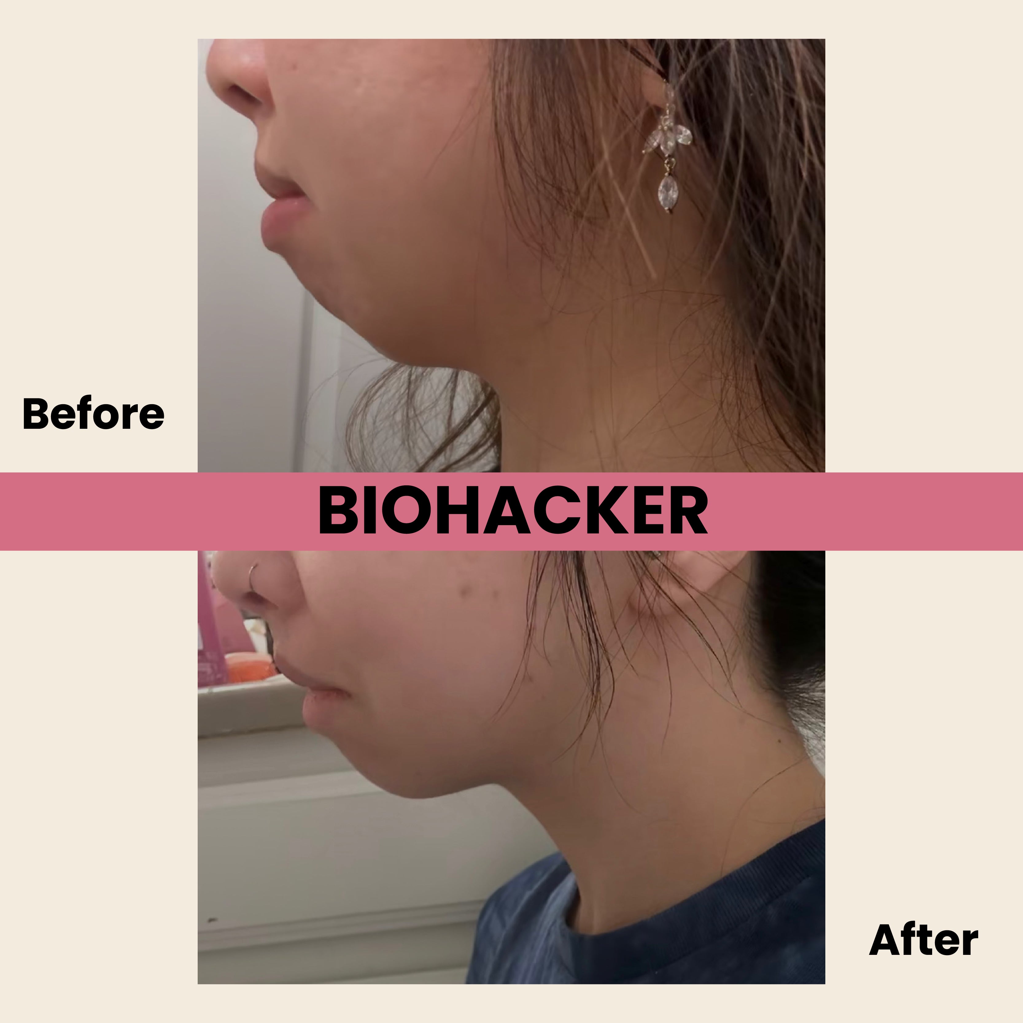 Biohackher Mouth Tape